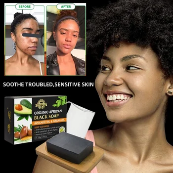 Sdotter חמאת שיאה שמן ארגן שחור אפריקאי סבון לחות תכשיר ניקוי של אקנה על עור נקי אכפת לי בעבודת יד סבון פנים הגוף.